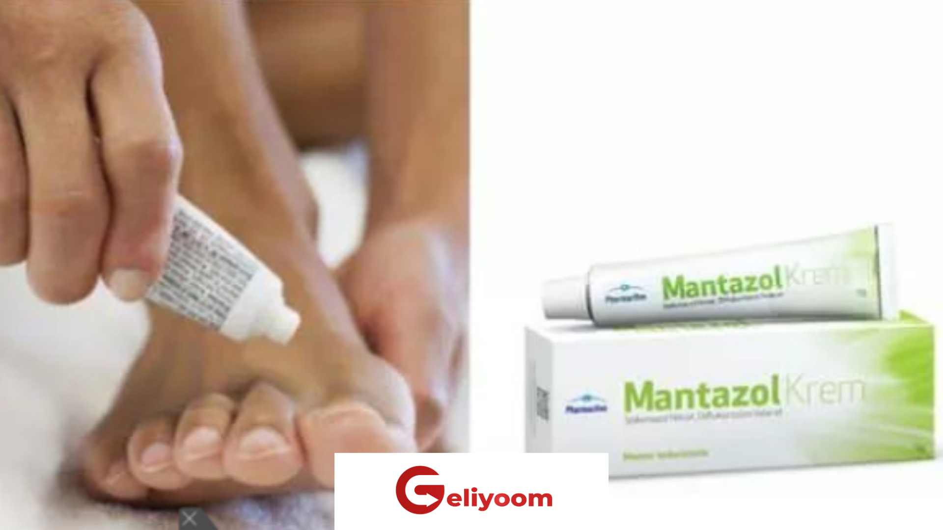 Mantazol Krem Nedir? Faydaları Nelerdir? - Geliyoom.com