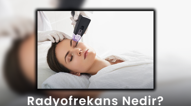 Radyofrekans Nedir?